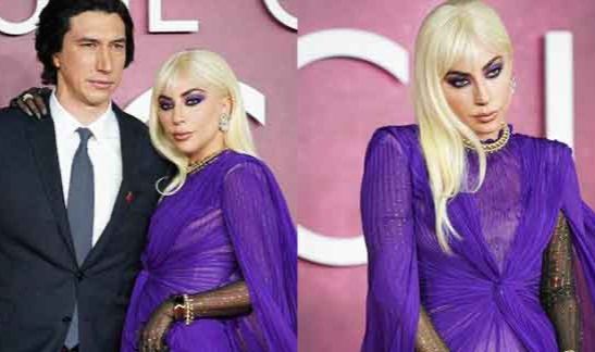 Lady Gaga... ÇİMEN YAPRAKLI EVLİLİK YÜZÜĞÜ İTİRAFI!..