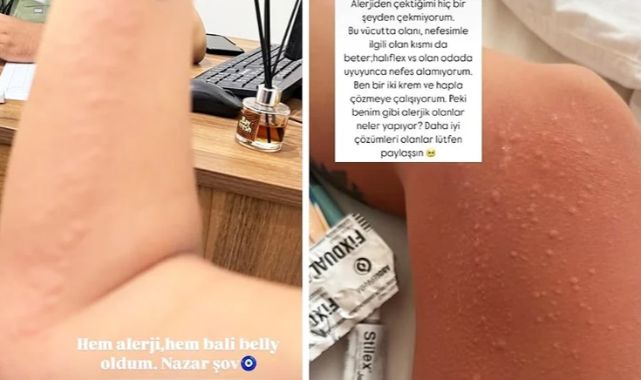 Ünlü şarkıcı hastanelik oldu: Bali Belly oldum